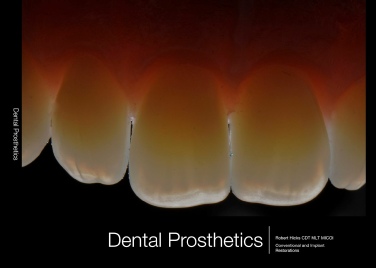 Dental Prosthetic Guide Book
